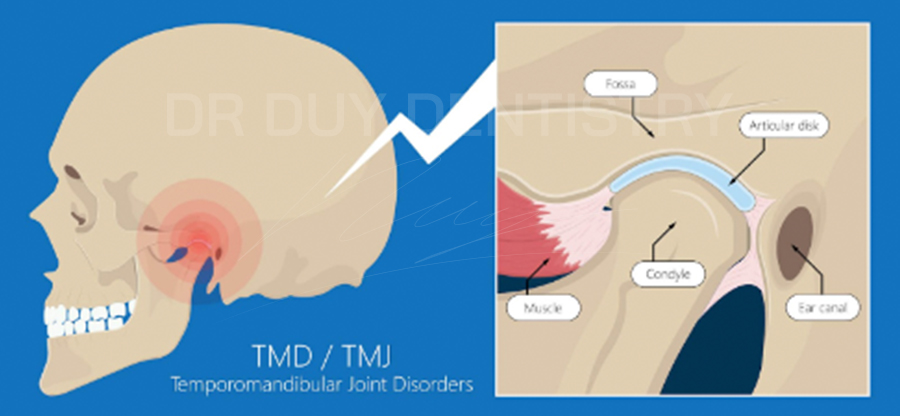 cắn ngược dr duy dentistry