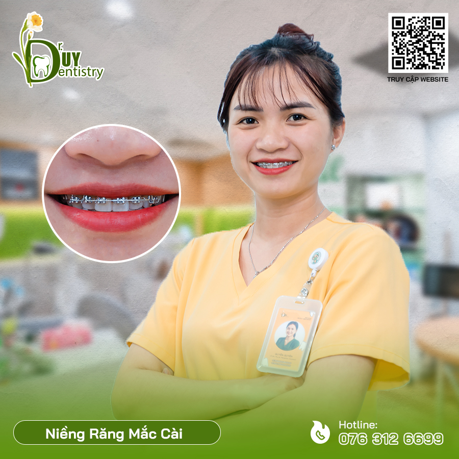 niềng răng lãi suất 0%