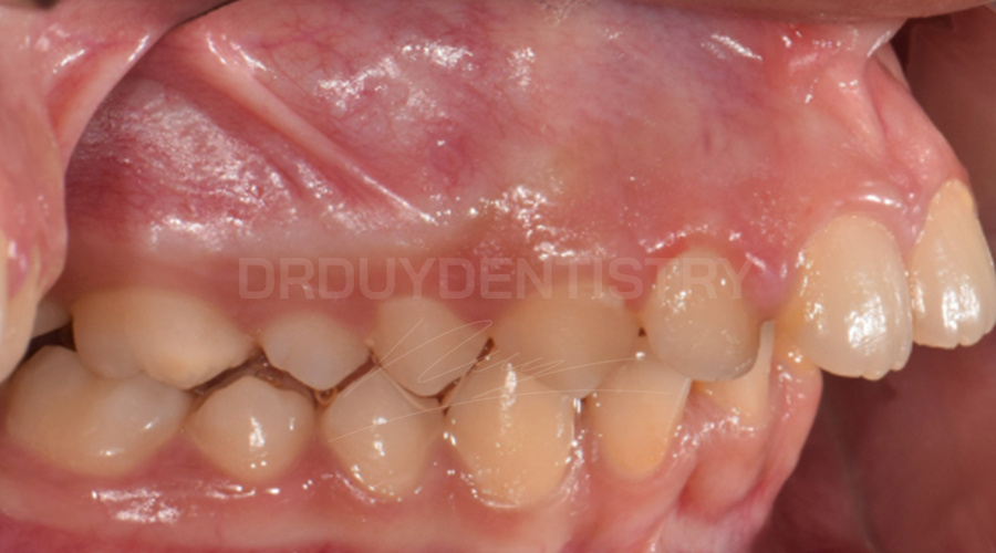 saikhopcan drduydentistry