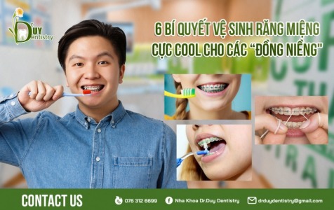 6 bí quyết vệ sinh răng miệng cực cool cho các “Đồng niềng”