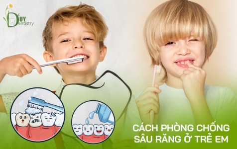 Cách phòng chống sâu răng ở trẻ em