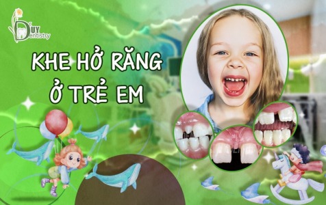 Khe Hở Răng Ở Trẻ Em