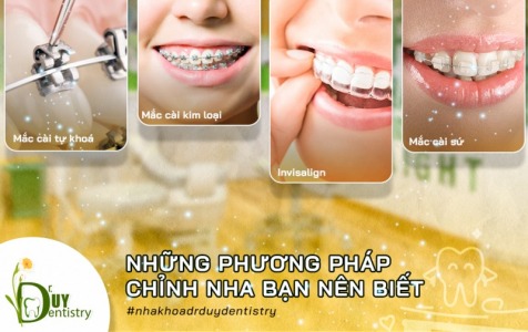 NHỮNG PHƯƠNG PHÁP CHỈNH NHA BẠN NÊN BIẾT