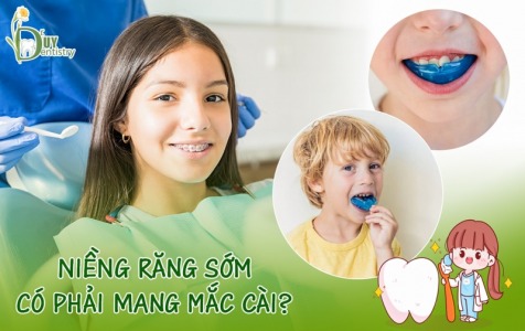 NIỀNG RĂNG SỚM CÓ PHẢI MANG MẮC CÀI?