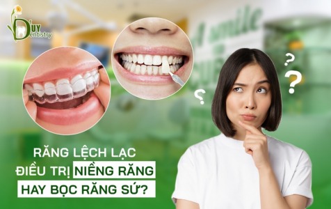 Răng lệch lạc - Điều trị niềng răng hay bọc răng sứ?