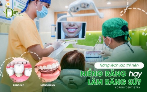 Răng lệch lạc thì nên niềng răng hay làm răng sứ?