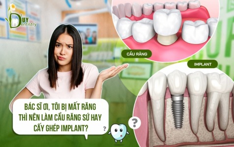 So Sánh Implant - Cầu Răng