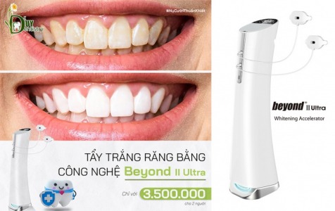 TẨY TRẮNG RĂNG VÀ NHỮNG ĐIỀU BẠN NÊN BIẾT