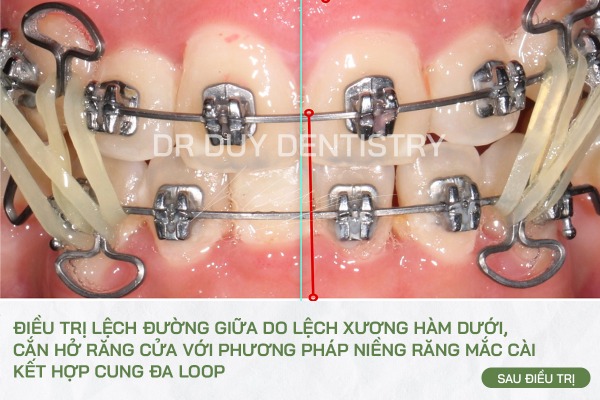 Dr Duy Dentistry