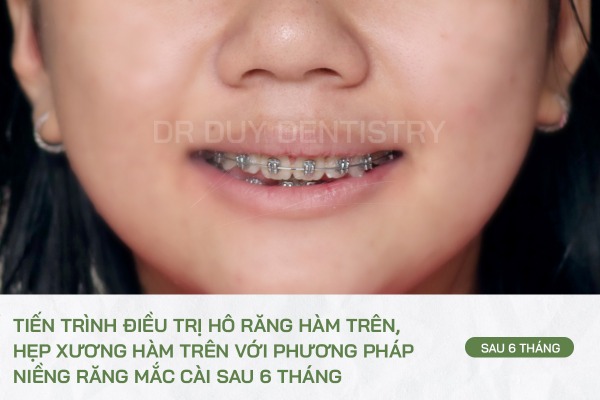 Dr Duy Dentistry