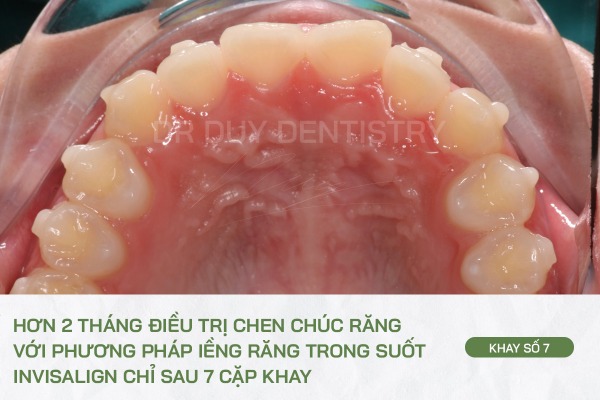 Dr Duy Dentistry