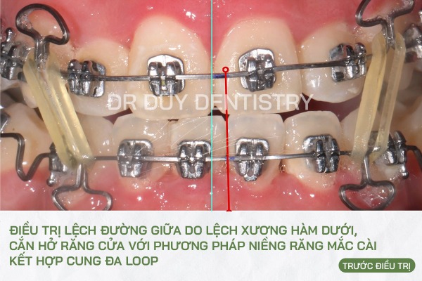 Dr Duy Dentistry