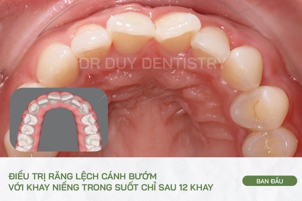 Dr Duy Dentistry