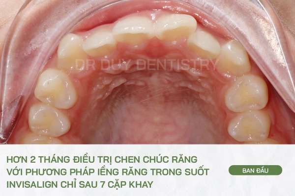 Dr Duy Dentistry